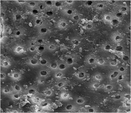 58 Figura 30 - Fotomicrografia obtida do terço apical após instrumentação