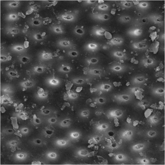 64 Figura 42 - Fotomicrografia obtida do terço apical após instrumentação