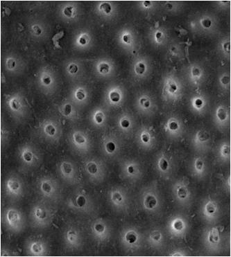 67 Figura 48 - Fotomicrografia obtida do terço apical após