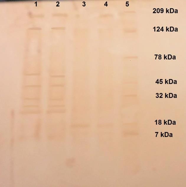 32 ANEXOS Anexo A - Membrana de nitrocelulose corada com corante cromogênico mostrando os resultados obtidos da técnica de Western blot realizada a partir de extrato proteico total de R.