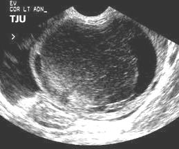abortamento vitalidade fetal Ecografia obstétrica 35-40