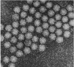 100 nm genoma dividido Tobravirus