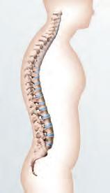 As ortóteses Spinomed endireitam as suas costas. A retroinformação biológica, conhecida por biofeedback, leva a um endireitamento natural e contínuo do seu tronco.