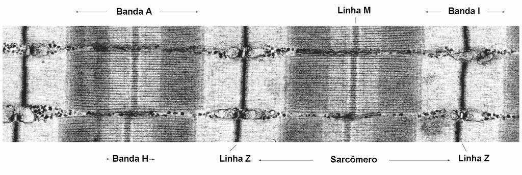 21 escura, enquanto no centro da banda A existe a banda H, de coloração mais clara com uma linha M central (BAYNES; DOMINICZACK, 2000). FIGURA 2. Ultraestrutura muscular (Adaptado de CRAIG, 2008).