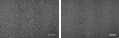 RESULTADOS E DISCUSSÃO As fotos de microscopia ótica comprovaram a existência de cristais micrométricos de indometacina na formulação ND 1, mesmo logo após nanoprecipitação, e ausência destes na ND 0