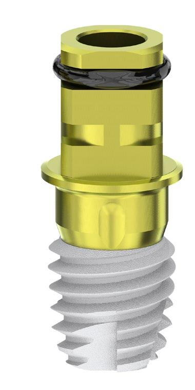 Implante Short O Implante Short é cilíndrico e auto-rosqueante com ápice ativo com quatro fresados.