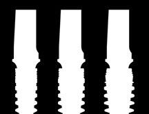 V L,5-3,75-4,0-4,3-5,0 Morse Indexado Bioplatform (tipo switch) - Linha única de componentes.