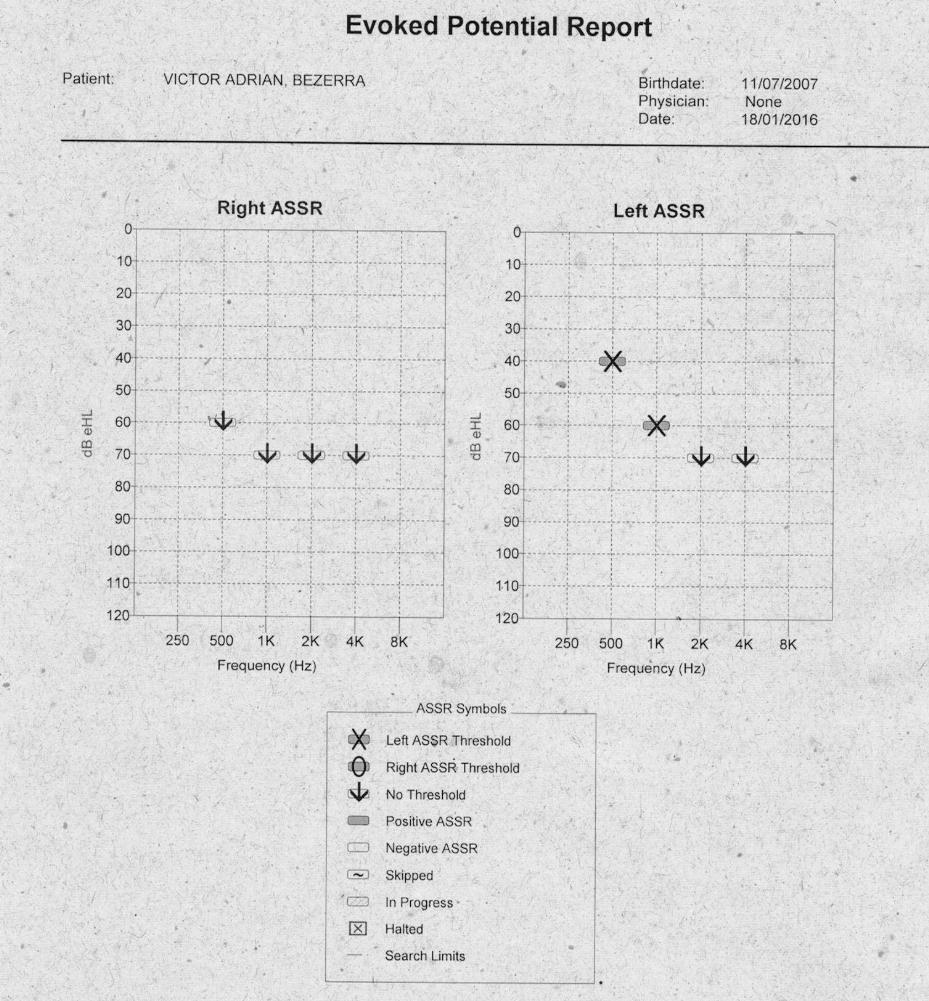 65 Figura 12 Gráfico resultado RAEE (ASSR).