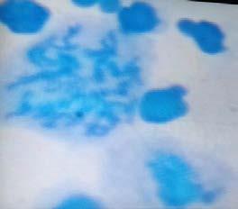 RESULTADOS Figura 2A Figura 2B Figura 2C Figuras 2A, 2B, 2C Cromossomos após a coloração com Giemsa 5%, durante a fase de metáfase, observados através do microscópio.