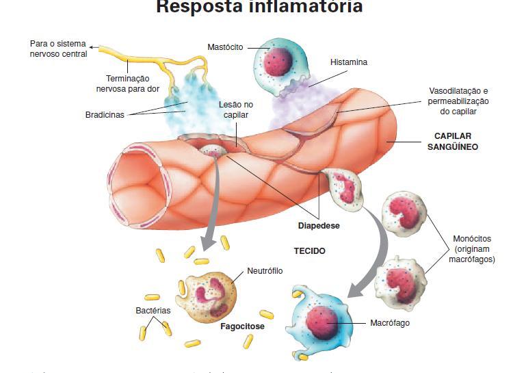 Formas Graves de Dengue DIS-REGULACÃO da reposta Inmunológica que é transitoria que tem como : CONSEQÜÊNCIA Vasculopatia inicialmente funcional.