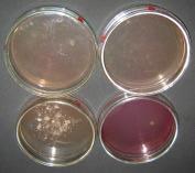 4 Segundo Konkewicz (2003), a centrifugação representa um ponto de recontaminação da roupa, devido ao fato de que a centrífuga aspira o ar ambiente, o qual estando contaminado aumentará o número de