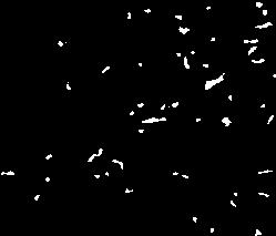 de tecido adiposo interlobular (Fig. 3), e em outros dois há necrose sublobular com desaparecimento de gru pos de ácinos (Fig.