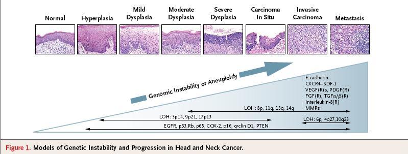 Modelo de carcinogénese: HPV (-) Instabilidade genómica (álcool, tabaco e higiene oral), originando: aneuploidia, mutações na p53 e na