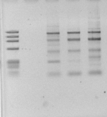 45 1 2 3 4 5 872 pb 603 pb 310 pb Figura 9 - Gel de agarose 1% para visualização dos fragmentos amplificados pelo primer Lep_3 do gene da leptina.