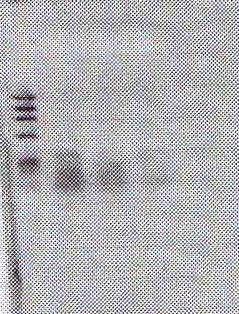 O fragmento esperado era de 272pb 1 2 3 4 5 1358 603 310 Figura 10 - Gel de agarose 1% para visualização dos fragmentos amplificados pelo primer Lep_4 do gene da
