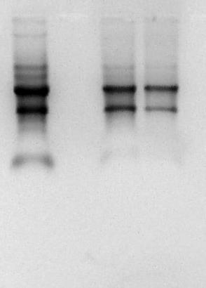 48 4.4.2 Extração e quantificação de RNA Foram realizadas diversas tentativas de amplificação do gene da leptina de Gallus gallus, porém não foi possível amplificar o gene a partir de DNA genômico.