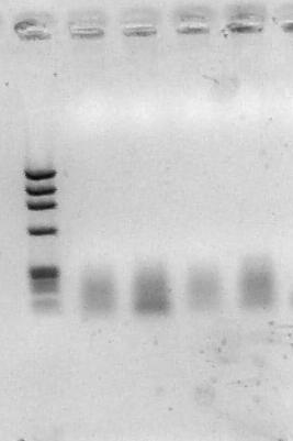 49 1 2 3 609 pb 310 pb Figura 12 - Gel de agarose 1% para visualização do fragmento de 409 pb do gene da beta-actina.