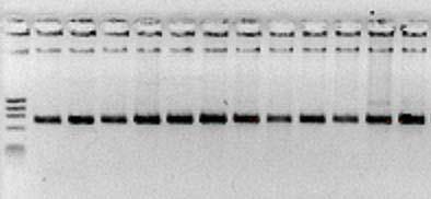 50 Após várias tentativas de amplificação do gene da leptina usando DNA e cdna, não foi detectado o fragmento esperado. Esses resultados corroboram os resultados encontrados por Friedman-Einant et al.