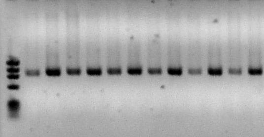 51 1 2 3 4 5 6 7 8 9 10 11 12 13 1358 pb 872 pb 940 pb Figura 15 - Gel de agarose 1% para visualização do fragmento amplificado pelo primer RL_2 do gene do receptor da leptina.