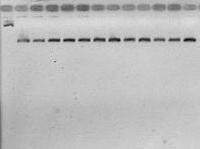 2 Purificação dos produtos da PCR Após a amplificação foi feita a purificação dos produtos da PCR do gene do receptor da leptina.
