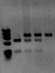 56 A genotipagem do polimorfismo G915A encontrado no íntron 19 foi realizada pela técnica de PCR-RFLP, usando a enzima de restrição Bsp1407I.