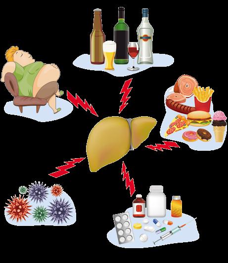 Principais inimigos do fígado Bebidas alcoólicas Obesidade e sedentarismo Má alimentação, rica