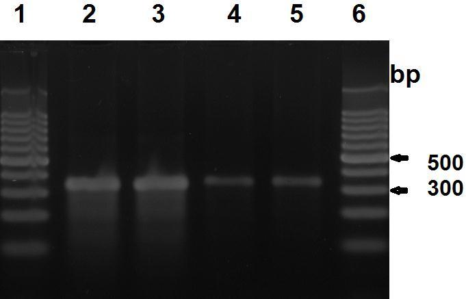 Dos 75 isolados analisadas pelo PCR-RFLP, todos amplificaram um produto de PCR do gene pta de 320 bp (Figura 1).