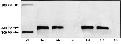 FIGURA 1- Amplificação do éxon 7 da CK-14 (190 pb) do DNA genômico obtido a partir da extração com fenol do material parafinado/congelado (P1/C1) e da extração com sílica/enzima do material