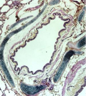 VIAS AÉREAS INTRAPULMONARES A traqueia bifurca-se nos brônquios primários (ou principais), que, ao entrarem nos pulmões, ramificam-se em três brônquios secundários (ou lobares) no pulmão direito e