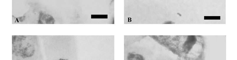 (C) Anáfase com ponte. (D) Telófase com cromossomo perdido. Barras = 10 µm.