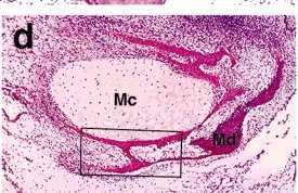 Mandíbula: CARTILAGEM DE MECKEL Mandíbula: Ossificação A