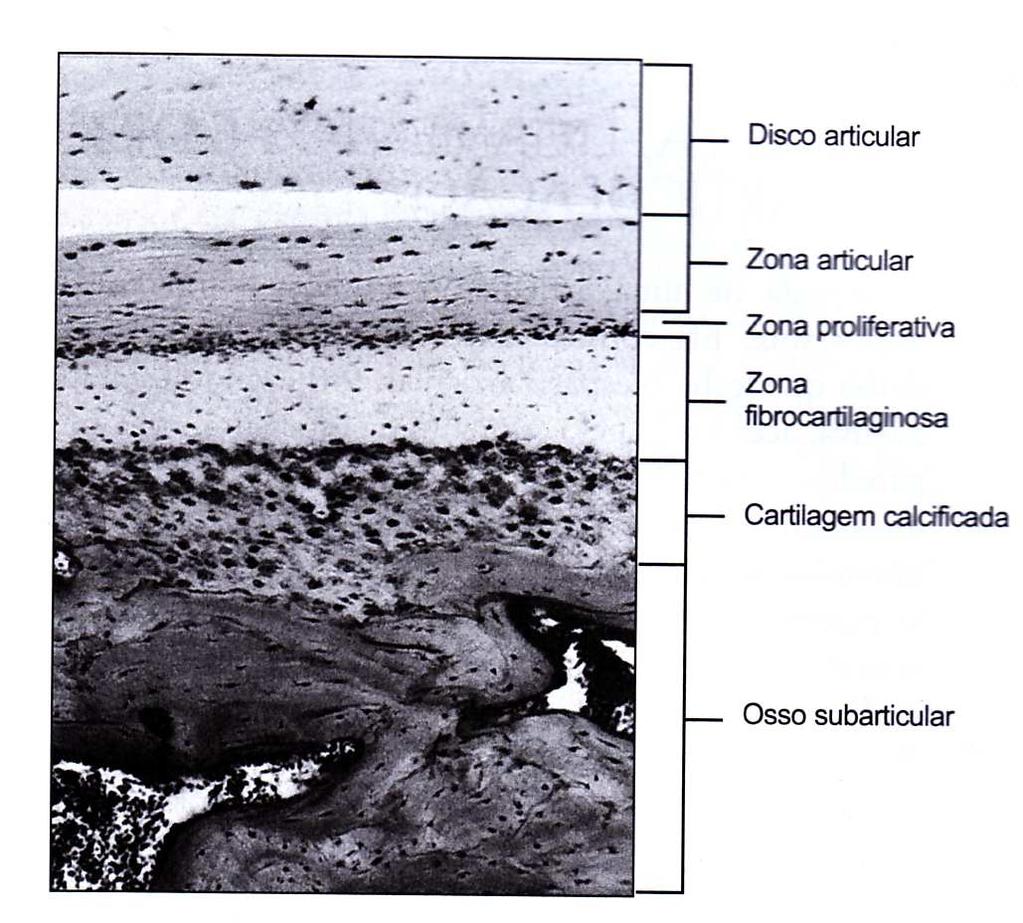 No Côndilo adulto, os condroblastos estão calcificados, mas a camada de células proliferativa permanece, e pode originar novos condrócitos para remodelagem. Disco articular Zona Articular (Tec.
