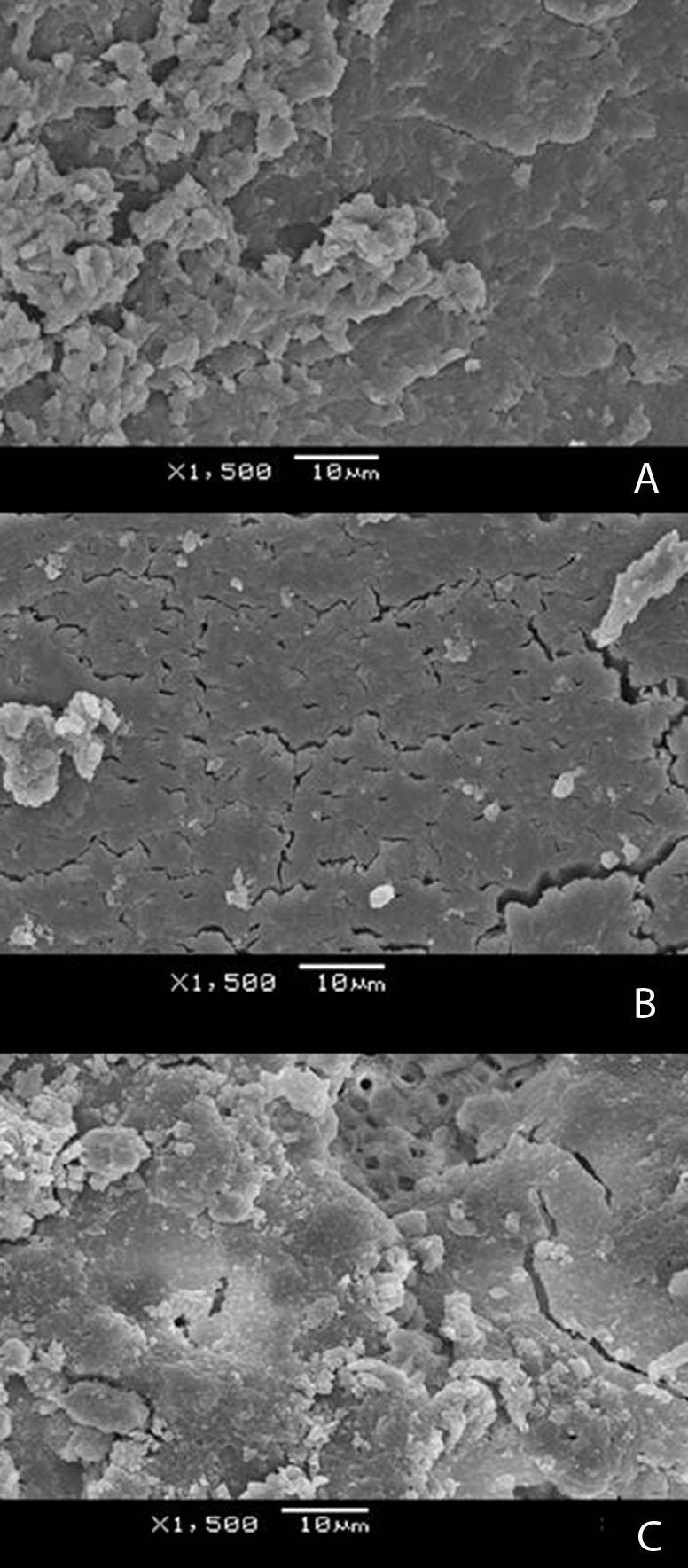 - 64 - Resultados Figura 8. Fotomicrografias da dentina radicular de espécimes irrigados com NaOCl 1%. A. Espécime não irradiado onde se evidencia a superfície recoberta pela camada de smear B.