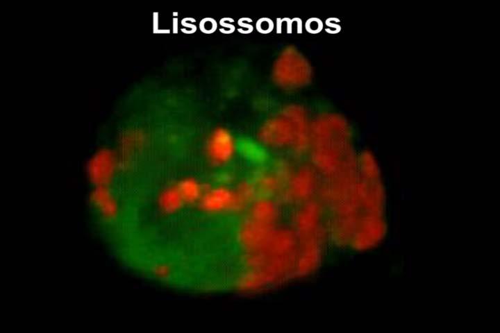 2 opticamente (corte ópticos), com o auxílio do microscópio confocal. Este é um microscópio de alta tecnologia, que usa laser como fonte de radiação.