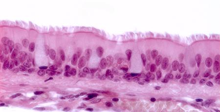 EPITÉLIO DE REVESTIMENTO Epitélio pseudoestratificado