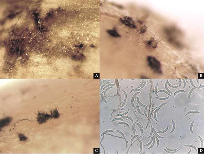 Colletotrichum