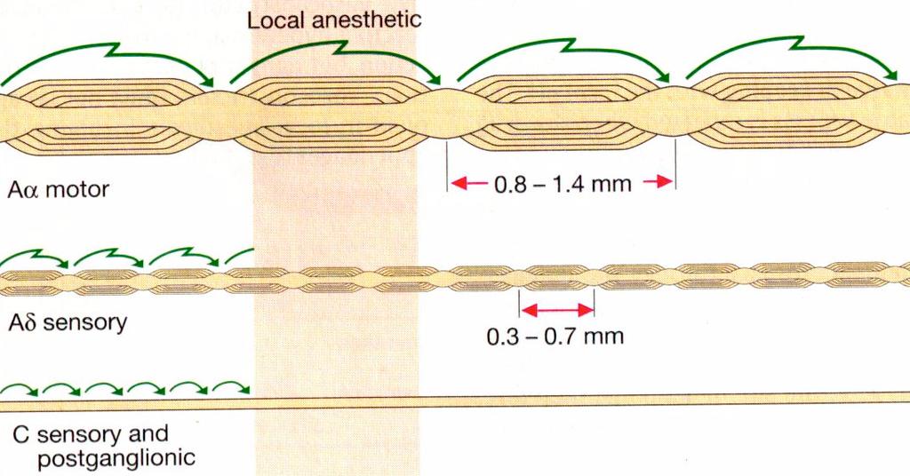 Anatomia X Bloqueio Anestésico Velocidade do bloqueio Diâmetro Mielinização Motor Dor Dor Anatomia X Bloqueio Anestésico Velocidade