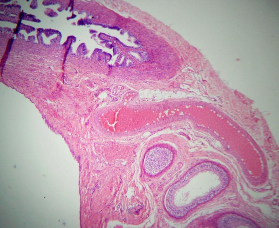 ISSN 0102-5716 ISSN Eletrônico 2178-3764 225 Figura 3. Imagem microscópica de gônada exibindo cortical com folículos ovarianos (seta) e internamente túbulos seminíferos degenerados. Aumento de 40x.