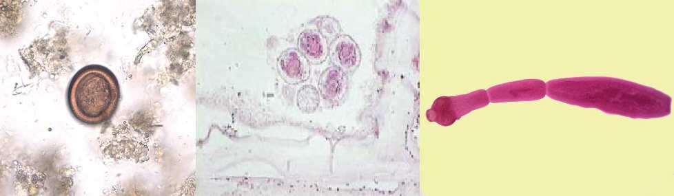 Quadro comparativot. solium x T. saginata LÂMINA 17.Echinococcusgranulosus NEVES, D. P. Parasitologia Humana. 11 ed. São Paulo: Atheneu, 2004.