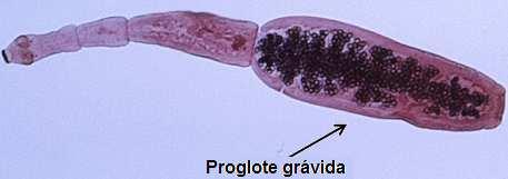 segmento grávido ocupa metade do corpo do parasito; http://coccidia.icb.usp.br/cestoides_taenia_echinococcus.
