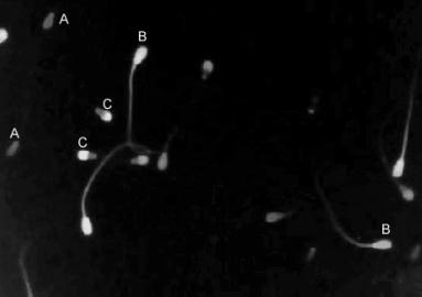 Figura 1 Coloração IP/CFDA. EspermatozóideS: (A) capacitado; (B) não capacitado; (C) morto. Microscópio DE EpifluorescÊNCIA, aumento DE 400X. Figura 2 Coloração tripla.