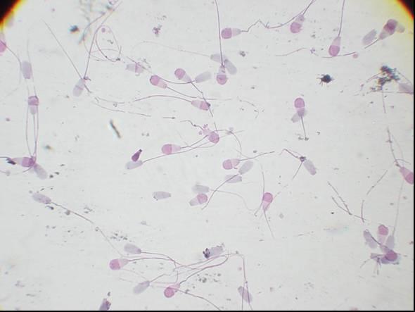 vários defeitos espermáticos (FIGURA 3).