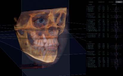 E ressalta: as informações em 3D obtidas pela TCFC possibilitam também o entrelaçamento com outros formatos de arquivos digitais, como fotografi as