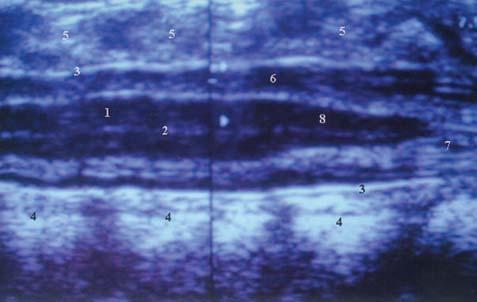 704 Arq Neuropsiquiatr 2004;62(3-A) Fig 1.