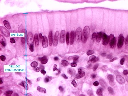 EPITÉLIO DE REVESTIMENTO Epitélio simples