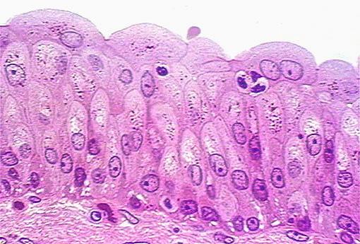EPITÉLIO DE REVESTIMENTO Epitélio de Transição - Recebe esse nome porque a forma e o nº de camadas celulares visíveis variam conforme o órgão