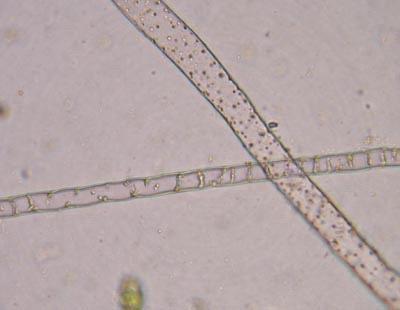 unicelulares Rizoides