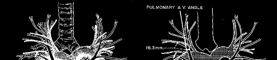 Pleura Pleura visceral e pleura parietal: saco de