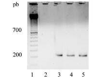 28 Prospecção de estirpes de Bacillus thuringiensis efetivas contra insetos da ordem Lepidoptera, Fig. 16.