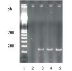 1- Marcador de massa molecular, 100bp DNA Ladder (Pharmacia), 2- Controle negativo, 3 - HD-1, 4 - S234 e 5 - S997 Fig.